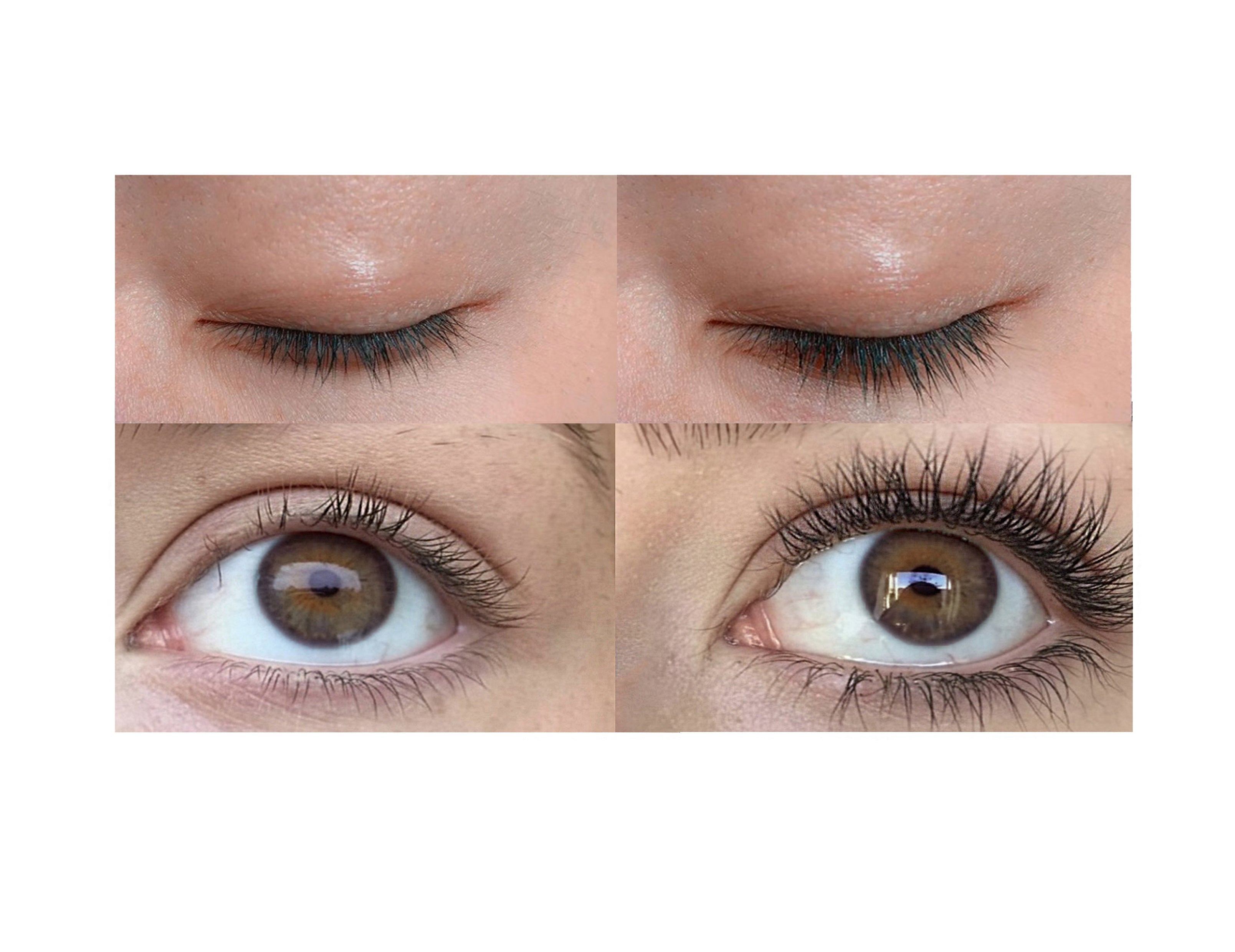 Before and After image of  using lash growth serum
